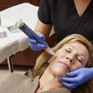 Microneedling