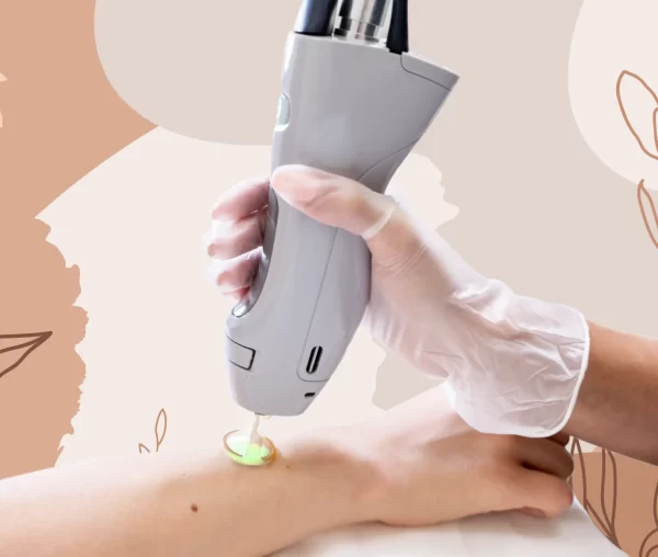Laser Hair Removal By Area
